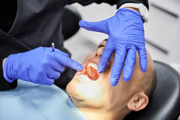Best Root Canal Emergency Dentist  in Diberville, MS